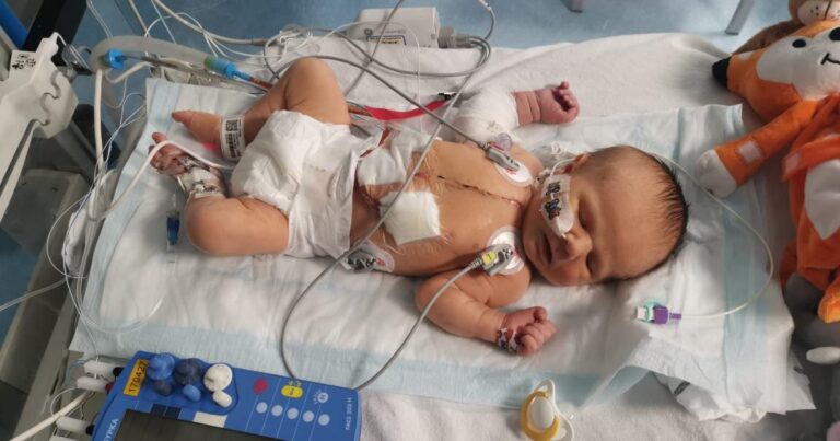 Fareham baby survived open heart surgery at seven days old